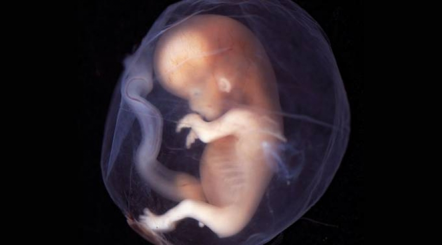 73% no quiere ley del aborto, revela encuesta del Senado en Chile