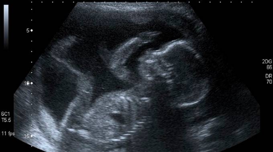 Aborto en Bolivia: obispos alertan ante avance de la cultura de muerte